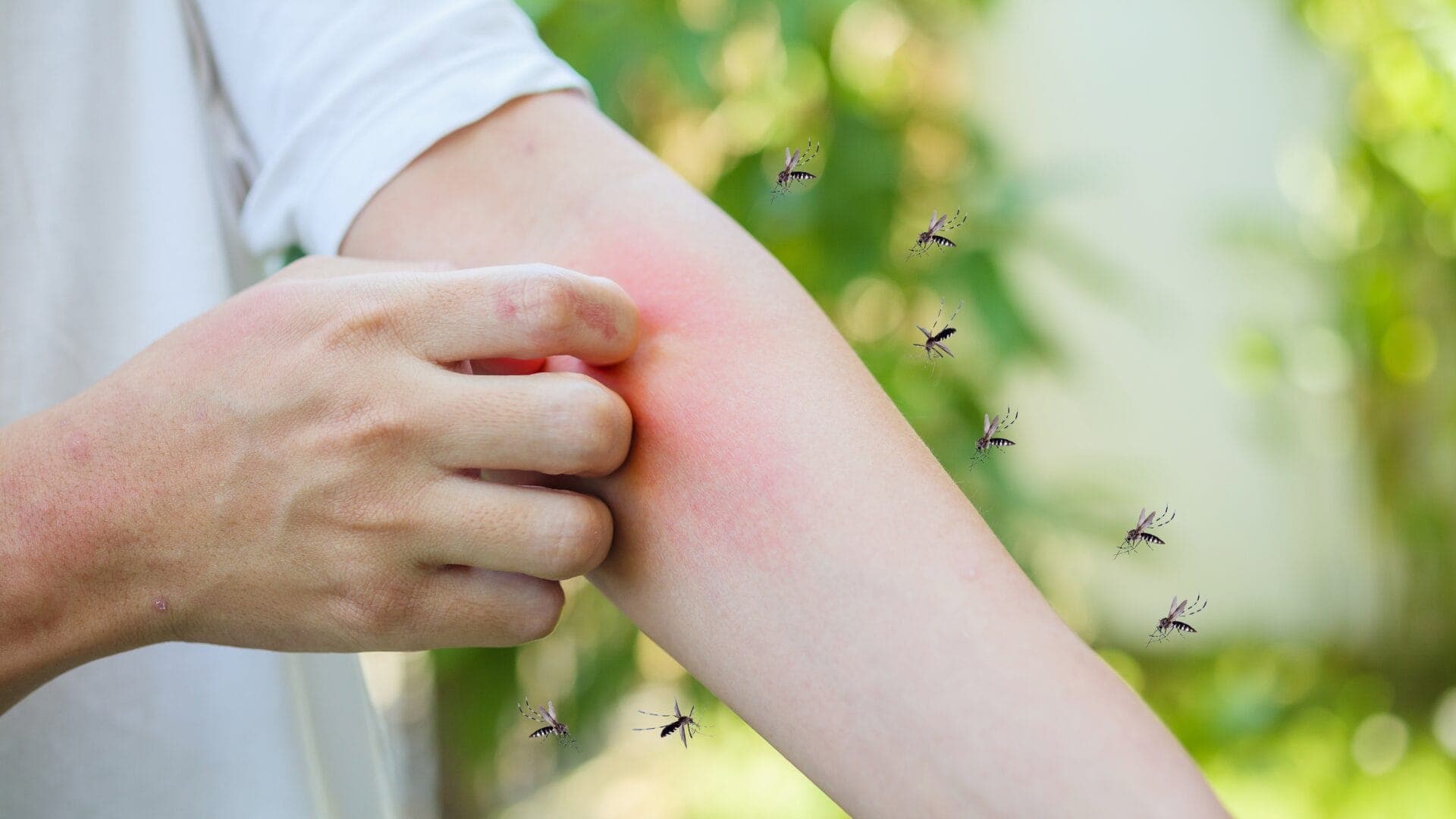 A Step-by-Step Guide to Managing Severe Allergic Reactions to Insect Stings